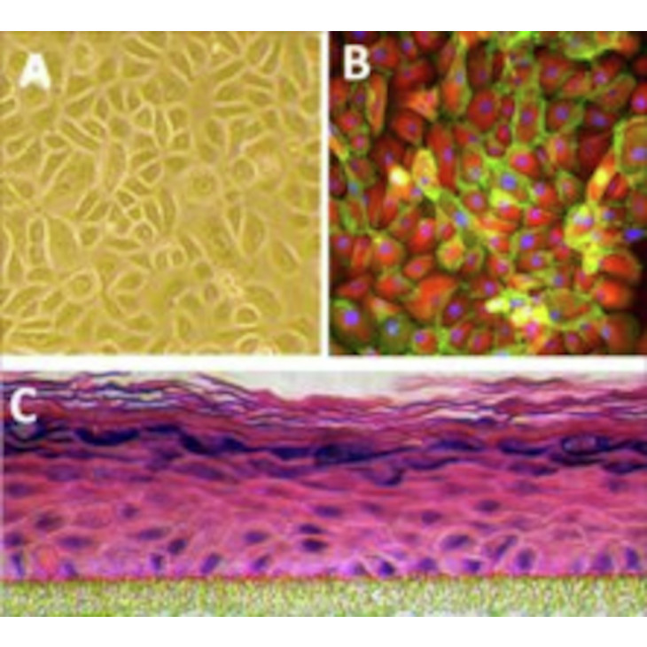 HUMAN EPIDERMAL KERATINOCYTES SIGMA 102-05A