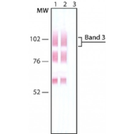 MONOCLONALE ANTI-BAND 3 SIGMA B9277 - .2ML